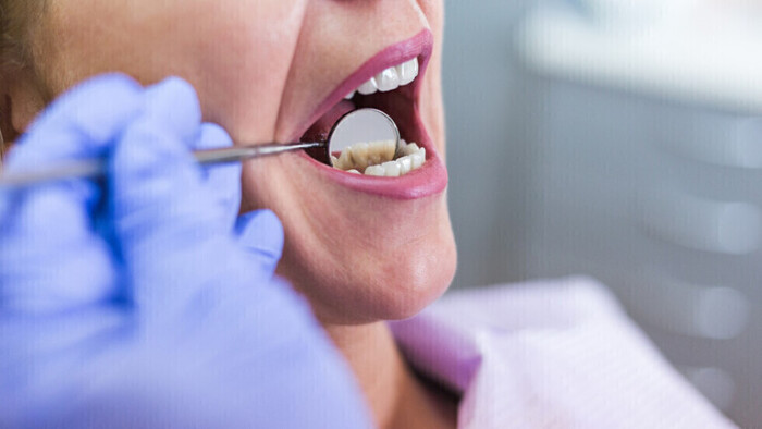 ماعلاقة صحة الأسنان بتلف الرئة؟