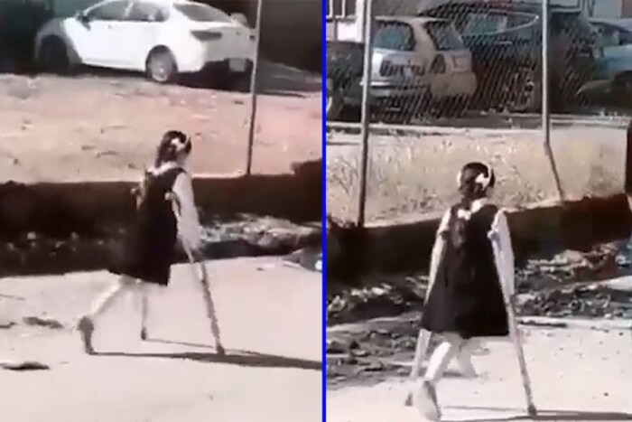 طفلة عراقية في الموصل  تنفض غبار الحرب وتسير برجل واحدة نحو المستقبل
