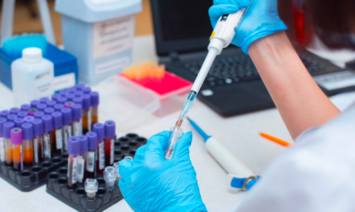 اختبار تعفن الدم يساعد على كشف السرطانات العدوانية في المراحل الأولى