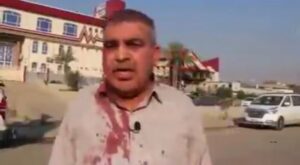 حماية مدير عام تعتدي بالضرب على رئيس مهندسين في وزارة الكهرباء