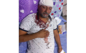 موظف بامانة بغداد يتعرض لاعتداء بآلة حادة (قامة) وحالته خطرة