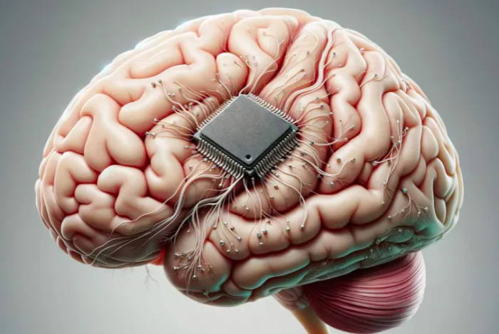 مشكلة تقنية تواجه أول شريحة تُزرع في دماغ بشري