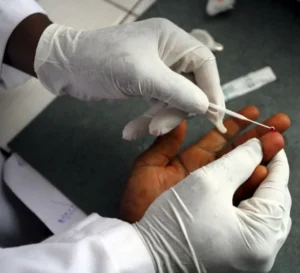 تُحذير من ارتفاع وفيات الملاريا في العالم